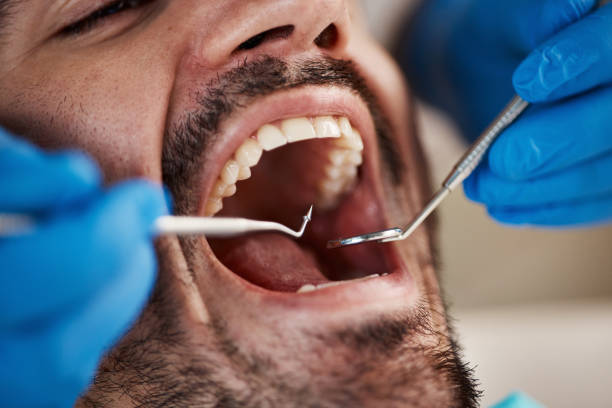 Best Emergency Denture Repair in Camp Hill, PA