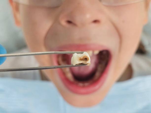 Best Emergency Dental Care for Sports Injuries in Camp Hill, PA